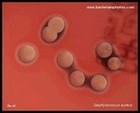 staphylococcus aureus